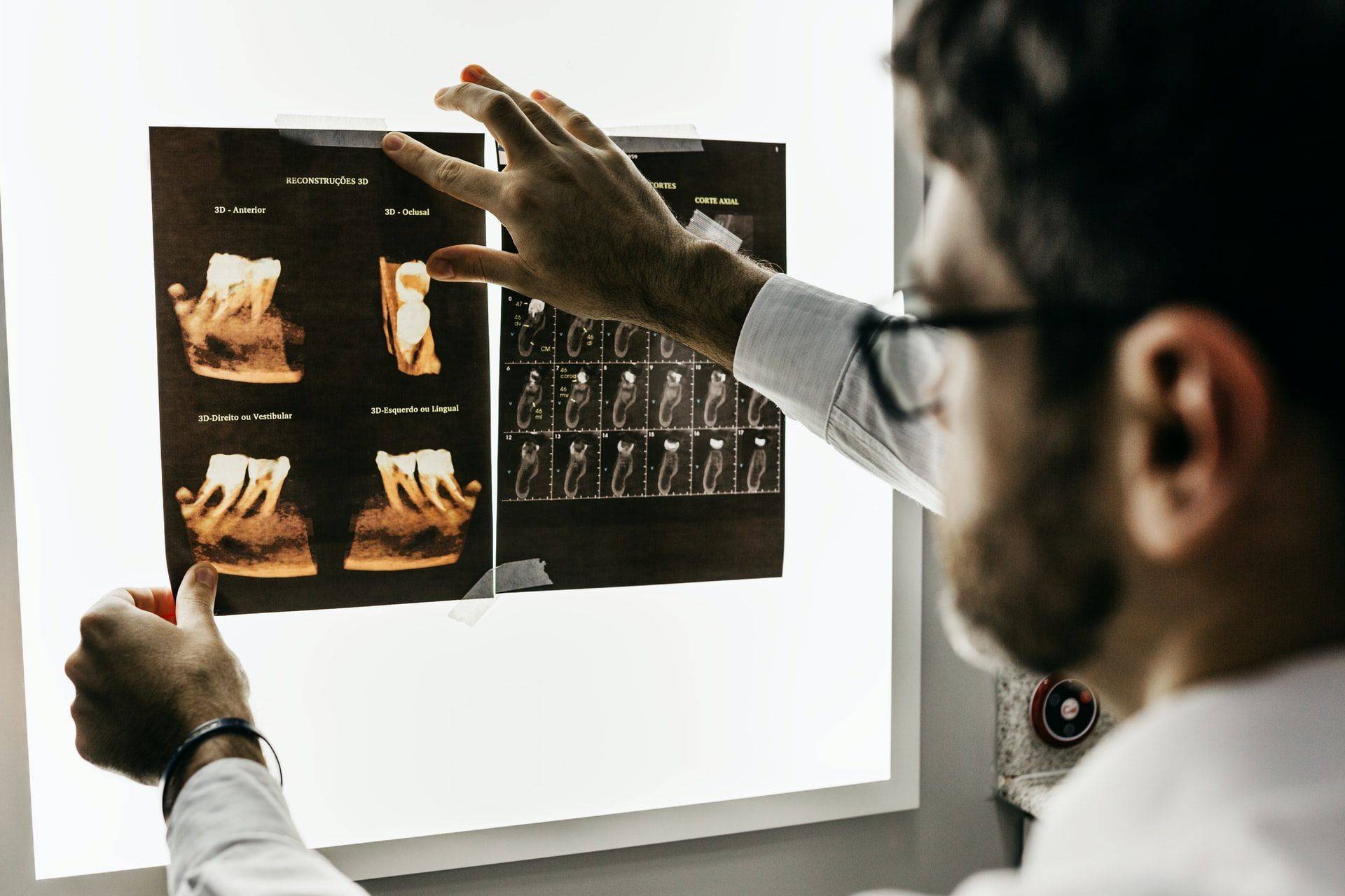 doctor examining x-ray scans to diagnose and determine treatment