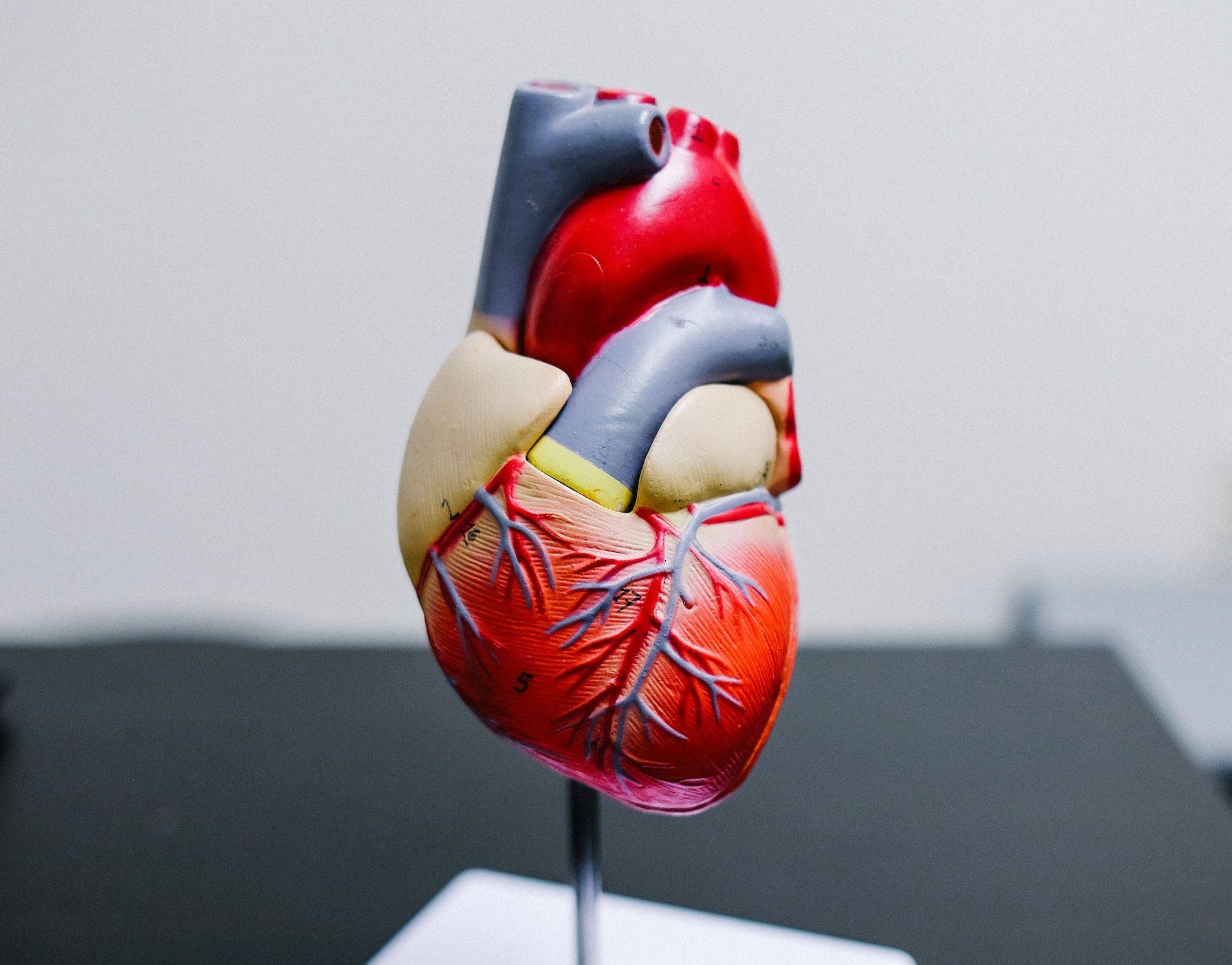 heart model explaining an angioplasty surgery