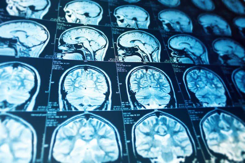 brain scans to diagnose preexisting conditions